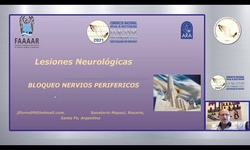 Lesiones neurológicas en nervios periféricos