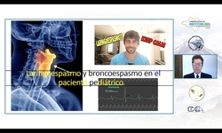 Módulo I: Pediatría crisis en sala de operaciones - Broncoespasmo y Laringoespasmo