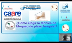 Módulo IX: Anestesia regional - Bloqueos para Plexo Braquial. ¿Cómo elegir la técnica?